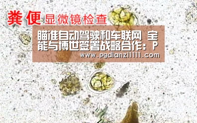 瞄准自动驾驶和车联网 宝能与博世签署战略合作:PG电子游戏(图3) PG电子APP下载